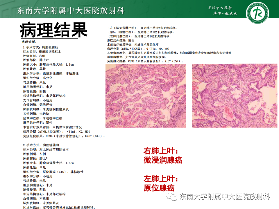 影像PPT - 【PPT】肺腺癌的CT影像表现-5 影像PPT - 【PPT】肺腺癌的CT影像表现-5