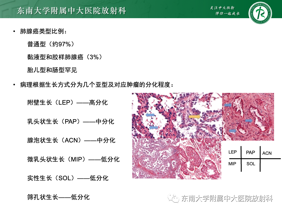影像PPT - 【PPT】肺腺癌的CT影像表现-12 影像PPT - 【PPT】肺腺癌的CT影像表现-12