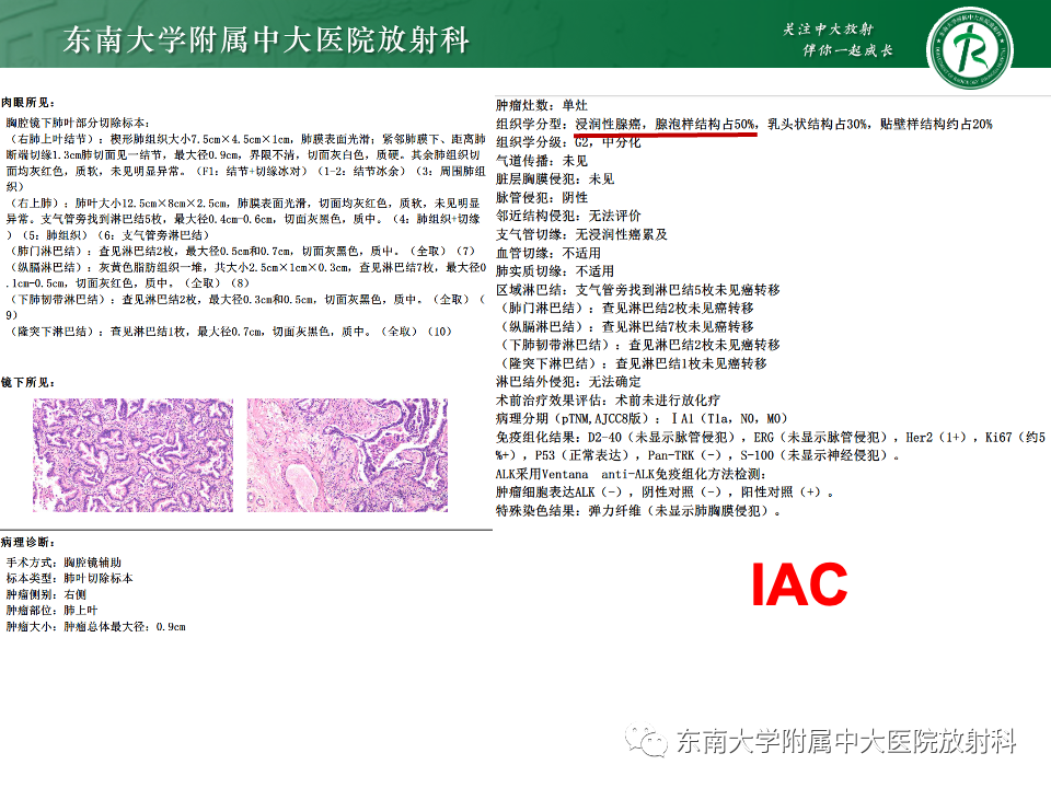 影像PPT - 【PPT】肺腺癌的CT影像表现-27 影像PPT - 【PPT】肺腺癌的CT影像表现-27