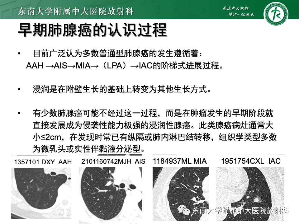 影像PPT - 【PPT】肺腺癌的CT影像表现-28 影像PPT - 【PPT】肺腺癌的CT影像表现-28