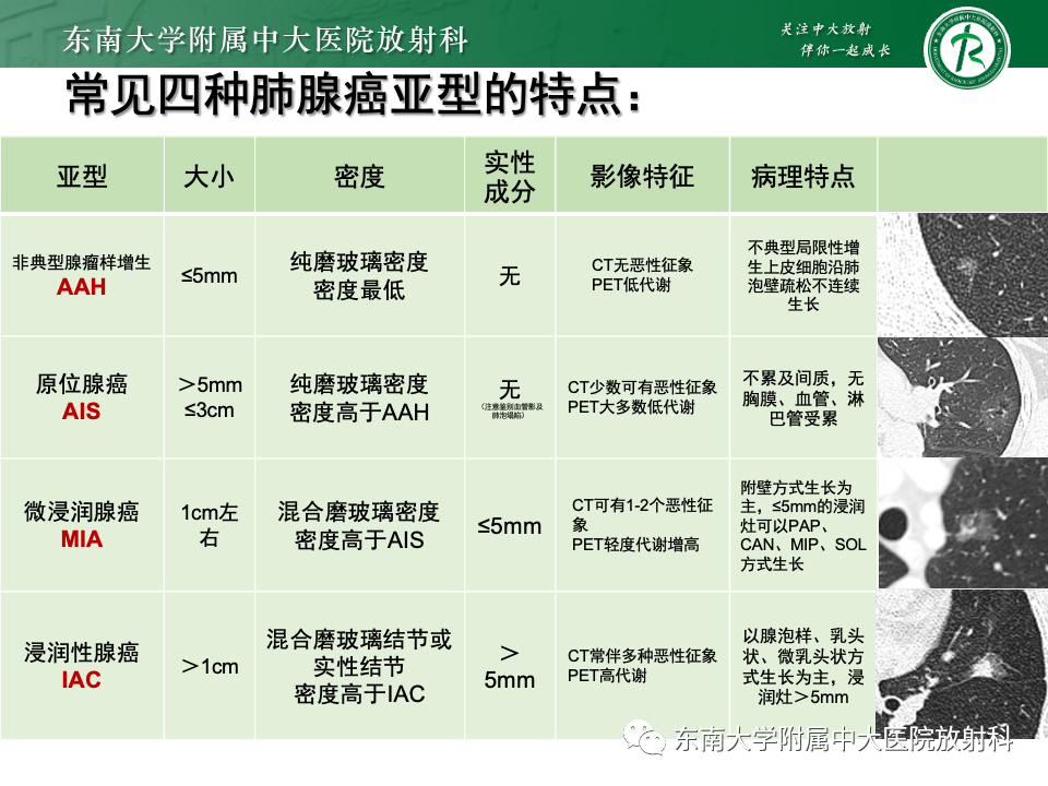 影像PPT - 【PPT】肺腺癌的CT影像表现-32 影像PPT - 【PPT】肺腺癌的CT影像表现-32