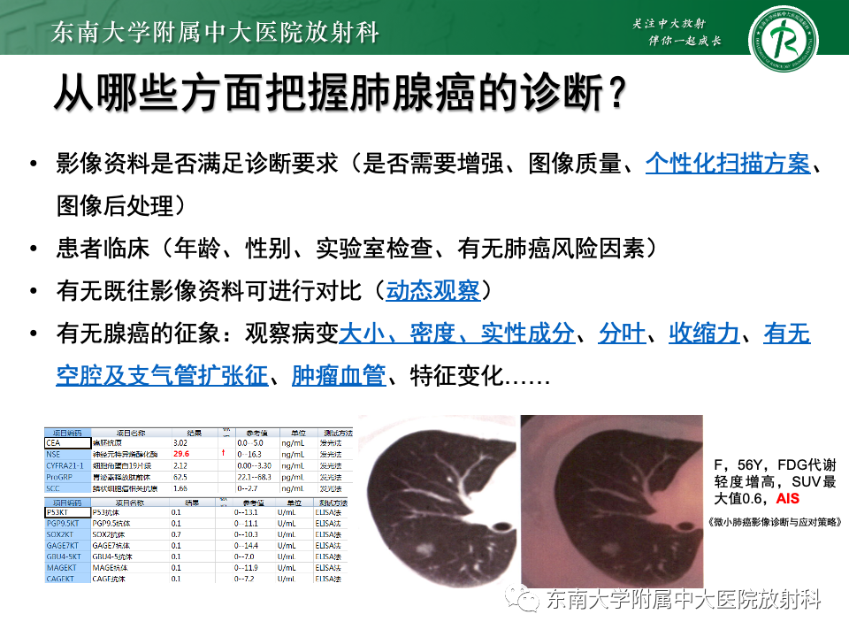 影像PPT - 【PPT】肺腺癌的CT影像表现-33 影像PPT - 【PPT】肺腺癌的CT影像表现-33