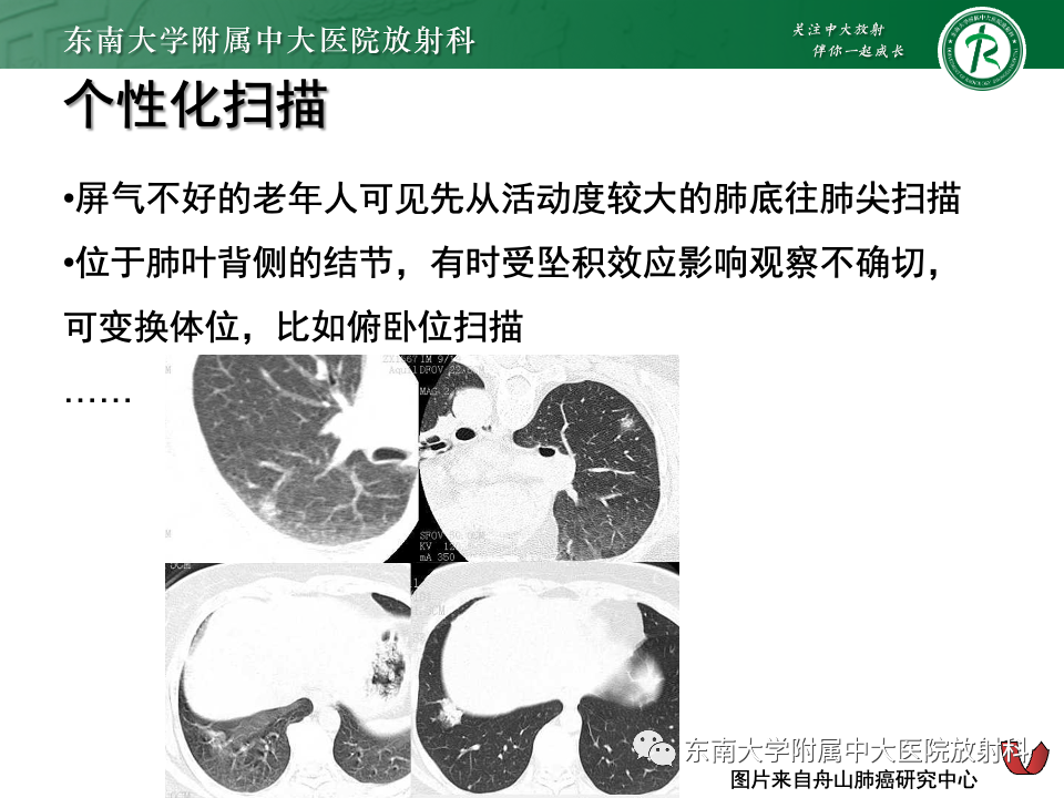 影像PPT - 【PPT】肺腺癌的CT影像表现-35 影像PPT - 【PPT】肺腺癌的CT影像表现-35