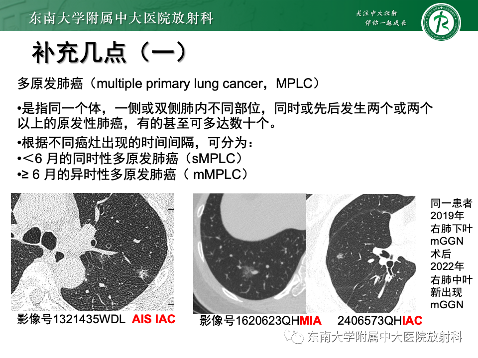 影像PPT - 【PPT】肺腺癌的CT影像表现-48 影像PPT - 【PPT】肺腺癌的CT影像表现-48