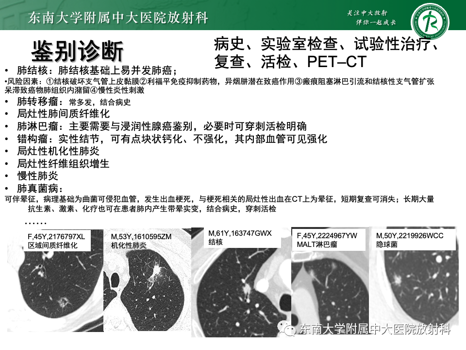 影像PPT - 【PPT】肺腺癌的CT影像表现-60 影像PPT - 【PPT】肺腺癌的CT影像表现-60