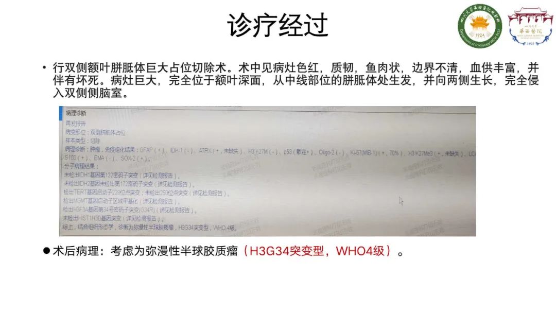 影像PPT - 【病例】弥漫性半球胶质瘤(H3G34突变型)1例MR影像-13
