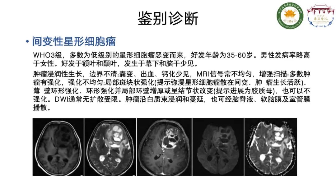 影像PPT - 【病例】弥漫性半球胶质瘤(H3G34突变型)1例MR影像-17
