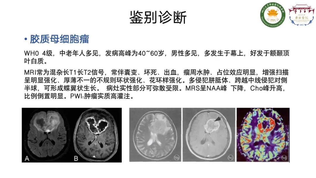 影像PPT - 【病例】弥漫性半球胶质瘤(H3G34突变型)1例MR影像-19