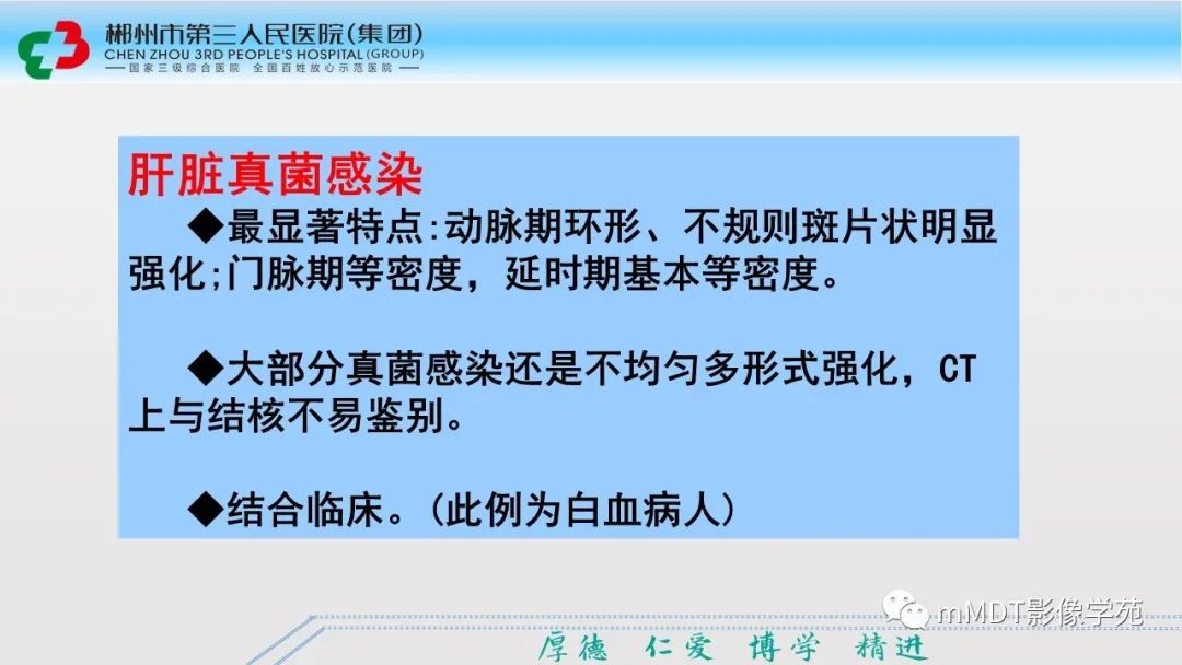影像PPT - 【PPT】肝脏结核的CT诊断-46