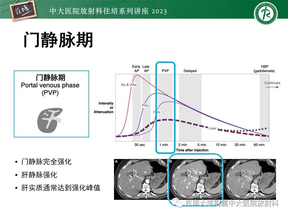 影像PPT - 【PPT】 肝脏影像通用术语和图谱解读-6