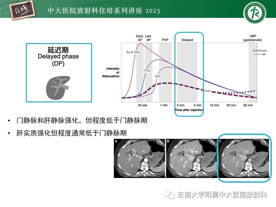 影像PPT - 【PPT】 肝脏影像通用术语和图谱解读-7