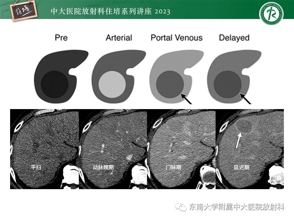 影像PPT - 【PPT】 肝脏影像通用术语和图谱解读-8