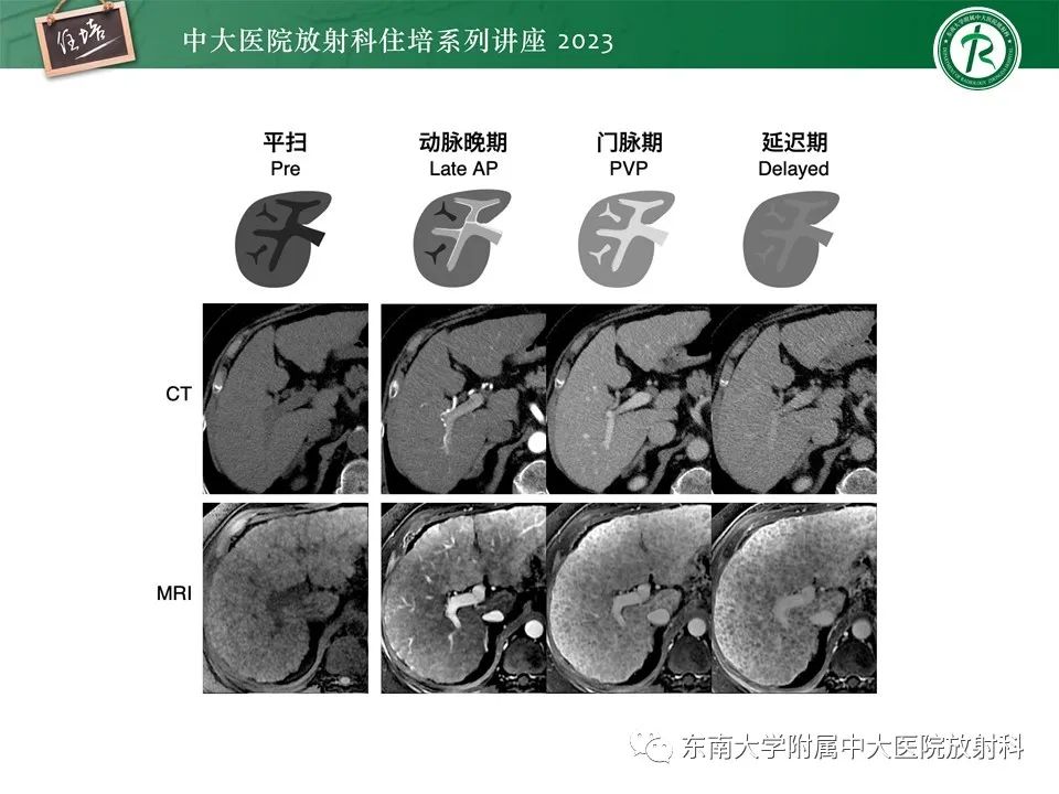 影像PPT - 【PPT】 肝脏影像通用术语和图谱解读-9