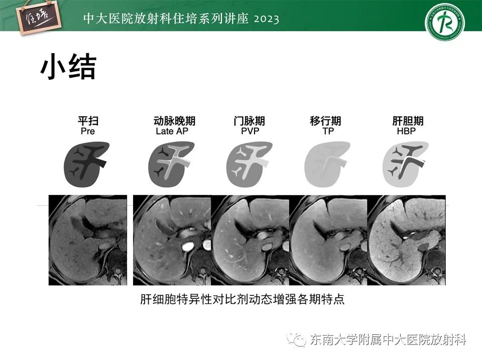 影像PPT - 【PPT】 肝脏影像通用术语和图谱解读-13