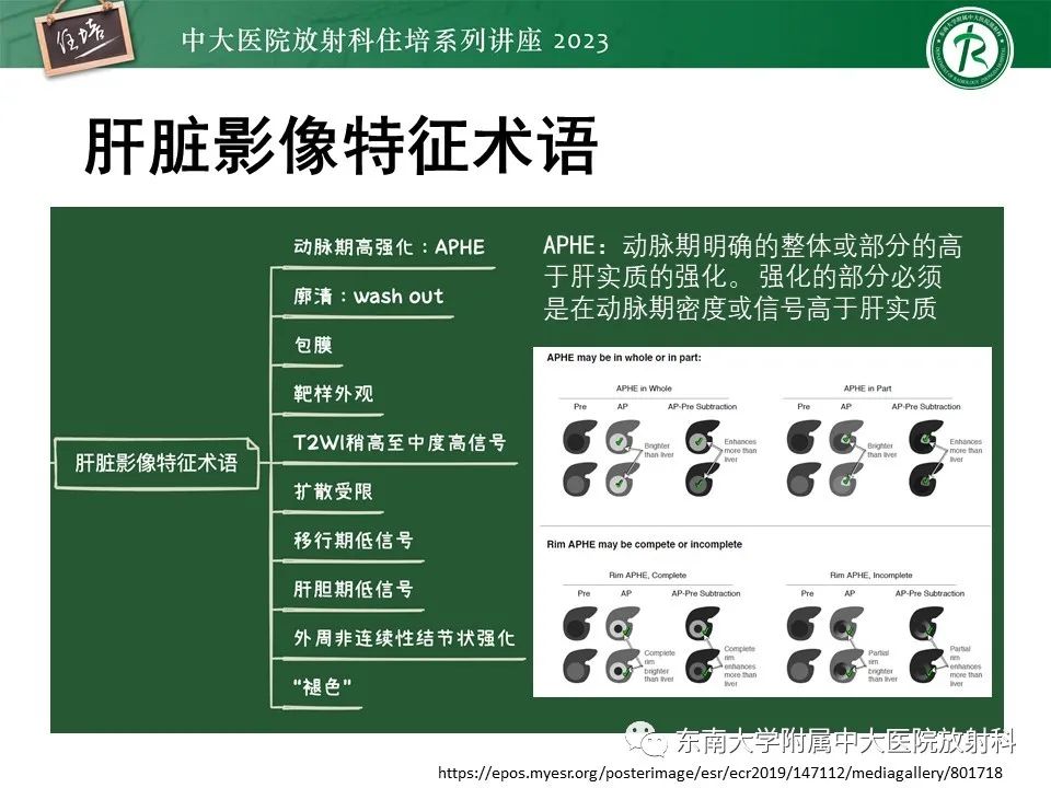 影像PPT - 【PPT】 肝脏影像通用术语和图谱解读-15