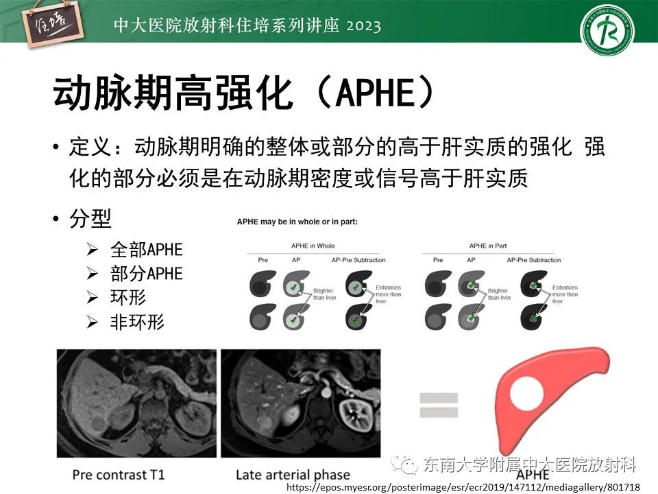 影像PPT - 【PPT】 肝脏影像通用术语和图谱解读-16