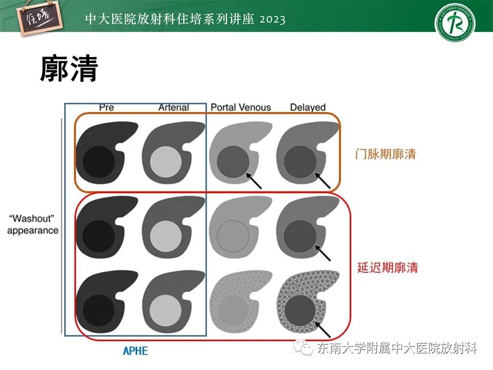 影像PPT - 【PPT】 肝脏影像通用术语和图谱解读-18