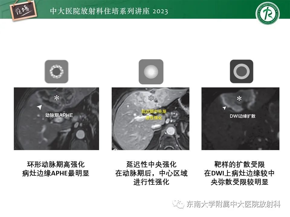 影像PPT - 【PPT】 肝脏影像通用术语和图谱解读-21