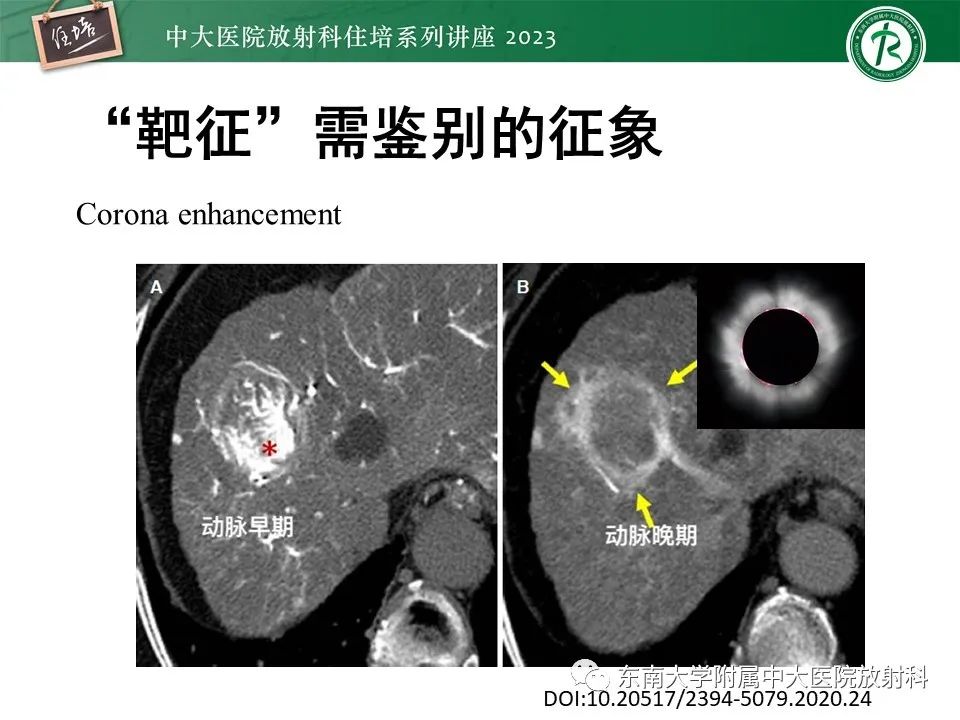 影像PPT - 【PPT】 肝脏影像通用术语和图谱解读-22