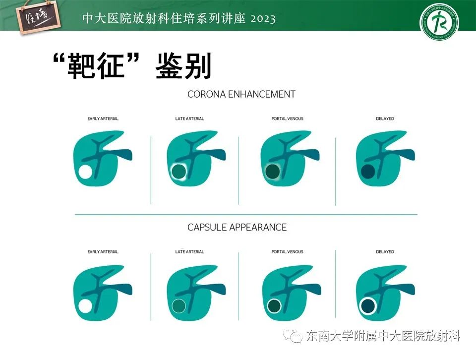 影像PPT - 【PPT】 肝脏影像通用术语和图谱解读-23