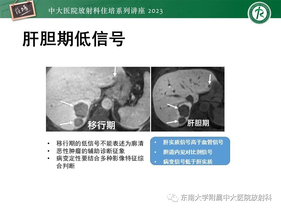 影像PPT - 【PPT】 肝脏影像通用术语和图谱解读-24