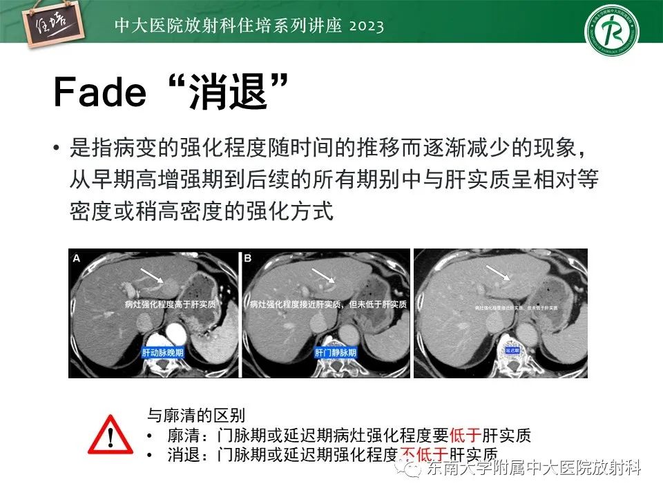 影像PPT - 【PPT】 肝脏影像通用术语和图谱解读-25
