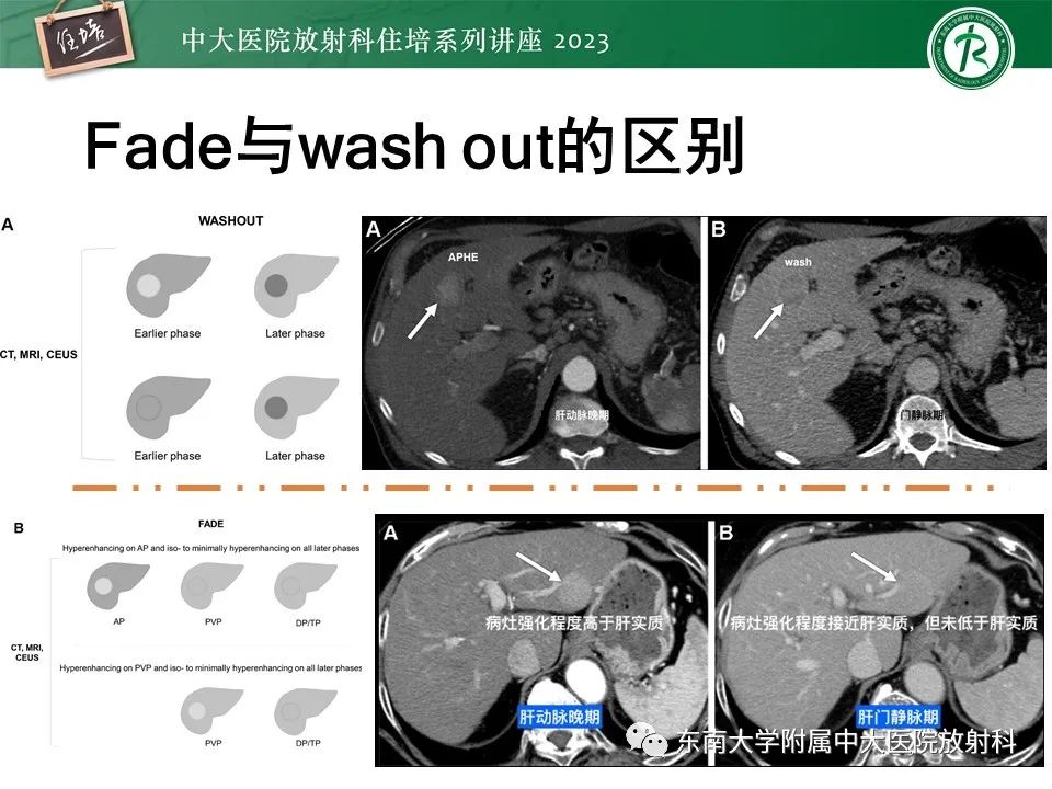 影像PPT - 【PPT】 肝脏影像通用术语和图谱解读-26