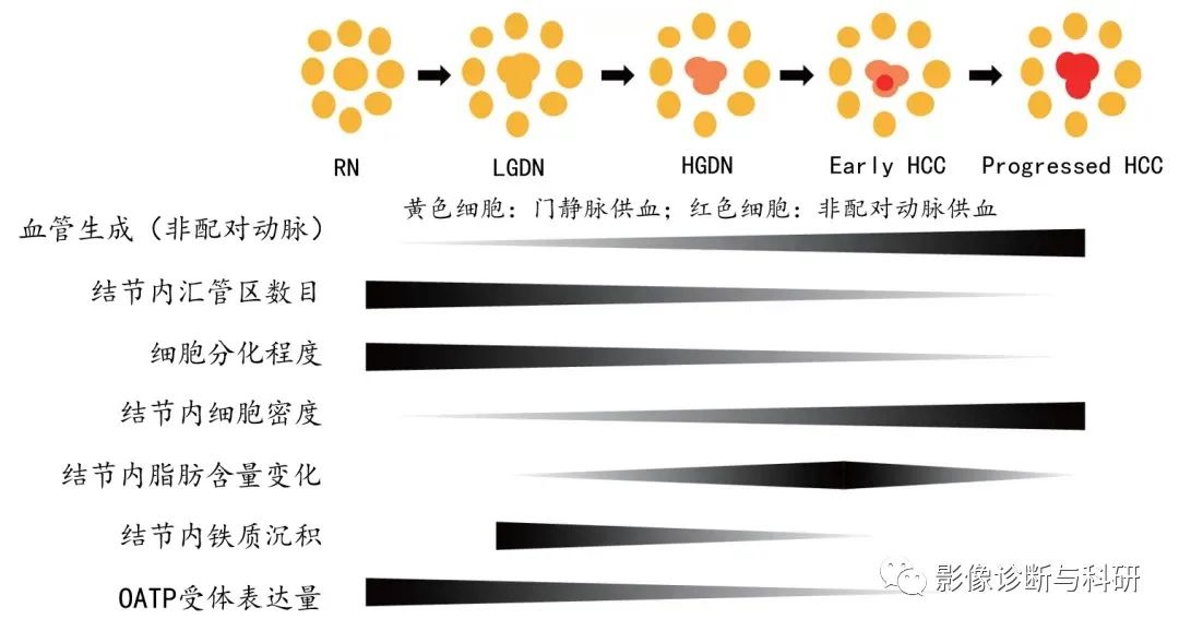 影像PPT - 肝硬化结节影像特征及如何判断是否癌变-2 影像PPT - 肝硬化结节影像特征及如何判断是否癌变-2
