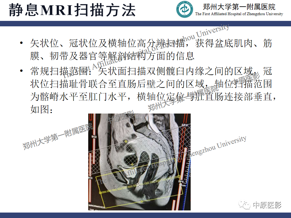 影像PPT - 【病例】盆底功能障碍性疾病2例MR影像-10