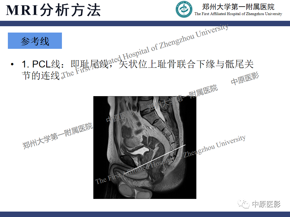 影像PPT - 【病例】盆底功能障碍性疾病2例MR影像-15