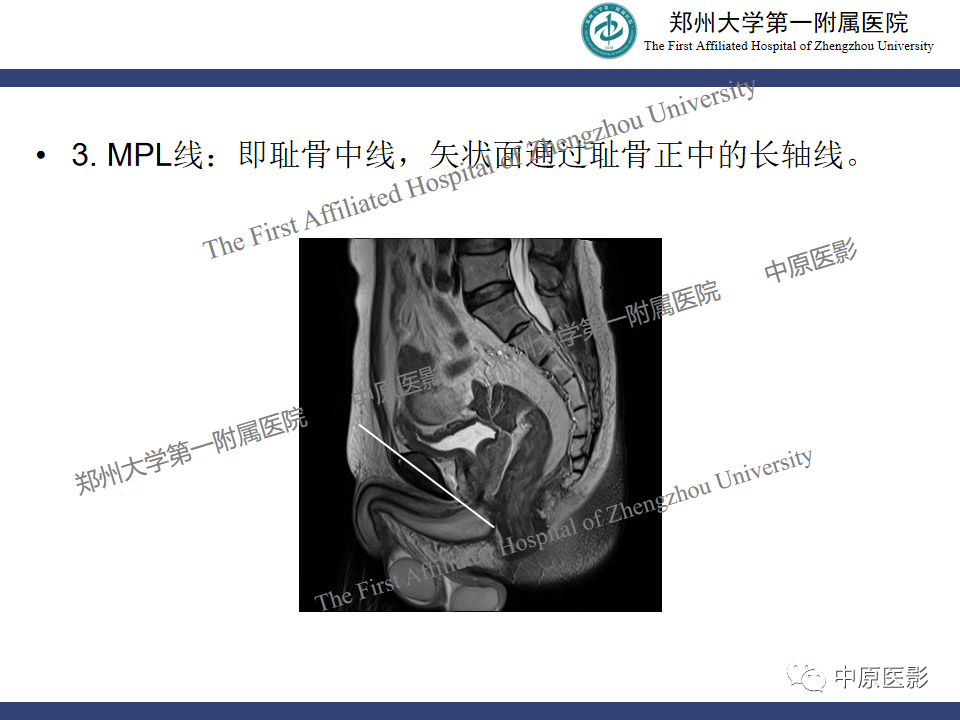 影像PPT - 【病例】盆底功能障碍性疾病2例MR影像-17