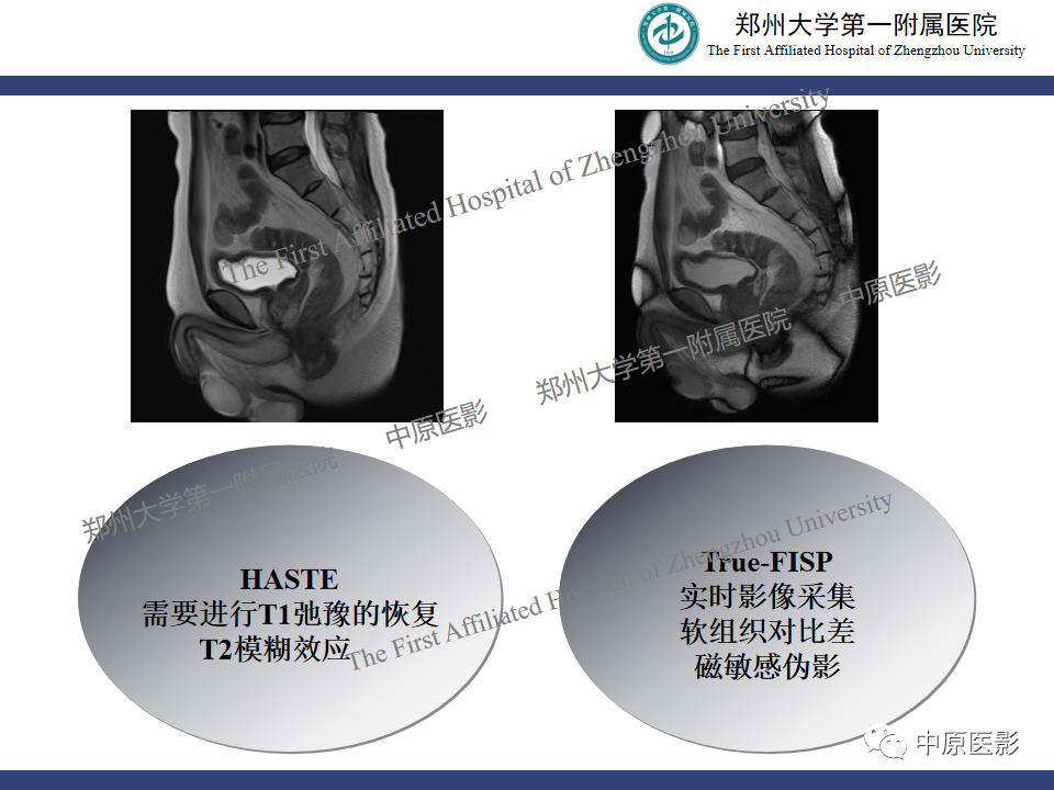 影像PPT - 【病例】盆底功能障碍性疾病2例MR影像-14
