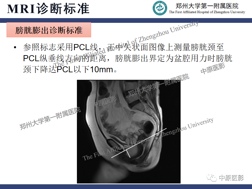 影像PPT - 【病例】盆底功能障碍性疾病2例MR影像-23