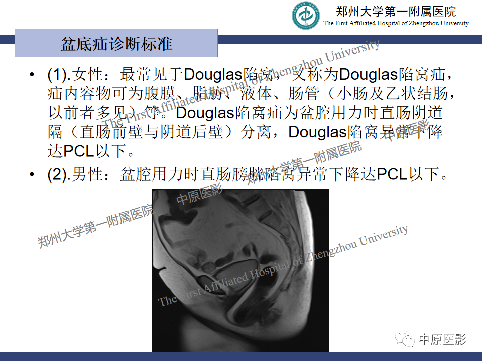 影像PPT - 【病例】盆底功能障碍性疾病2例MR影像-26