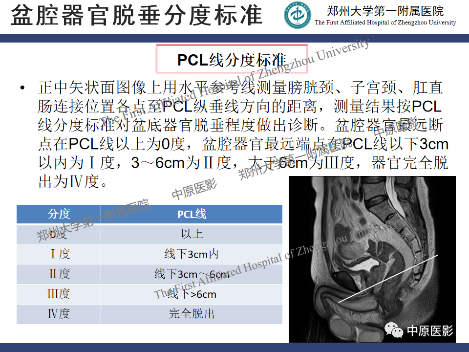影像PPT - 【病例】盆底功能障碍性疾病2例MR影像-28