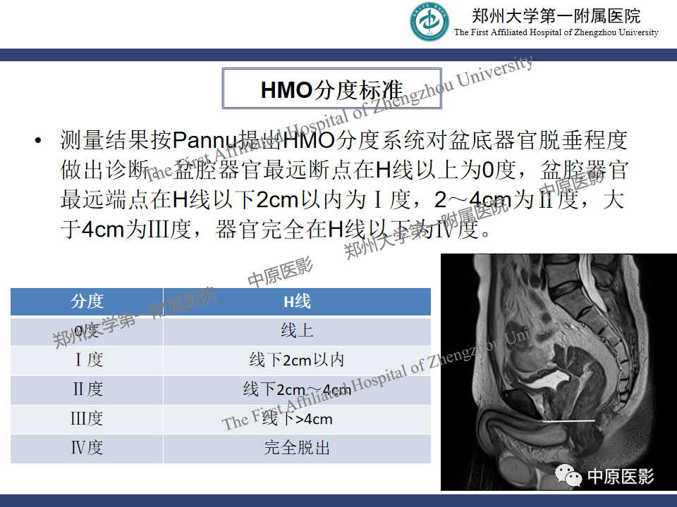 影像PPT - 【病例】盆底功能障碍性疾病2例MR影像-29