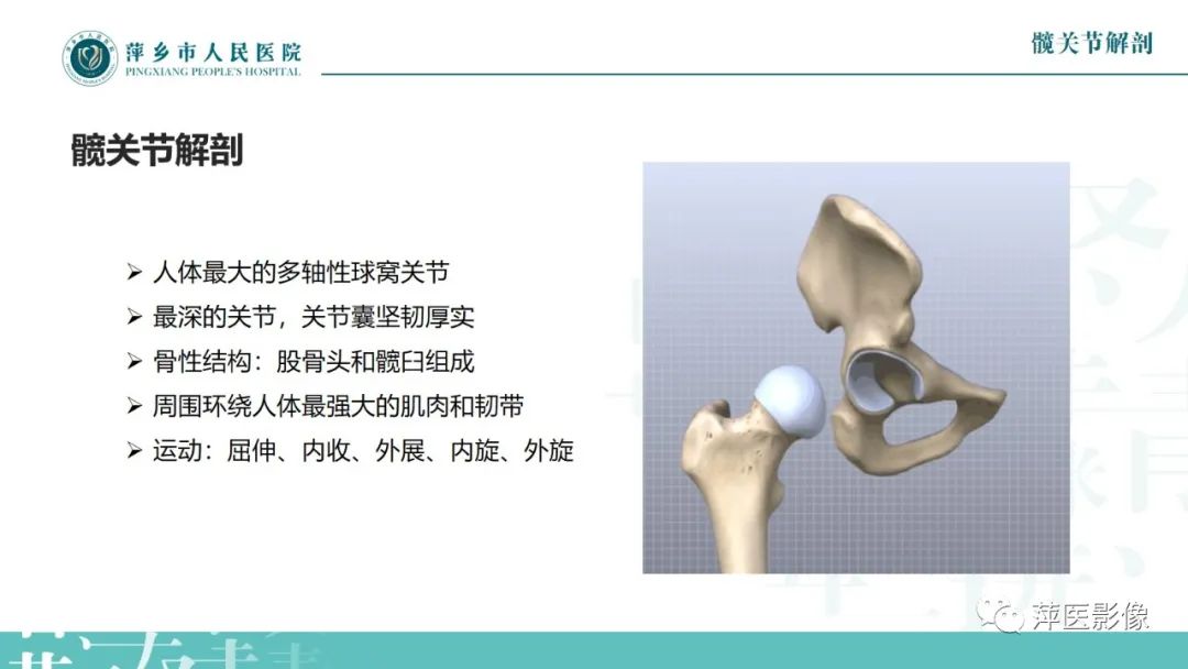 影像PPT - 【PPT】髋关节撞击综合征-4