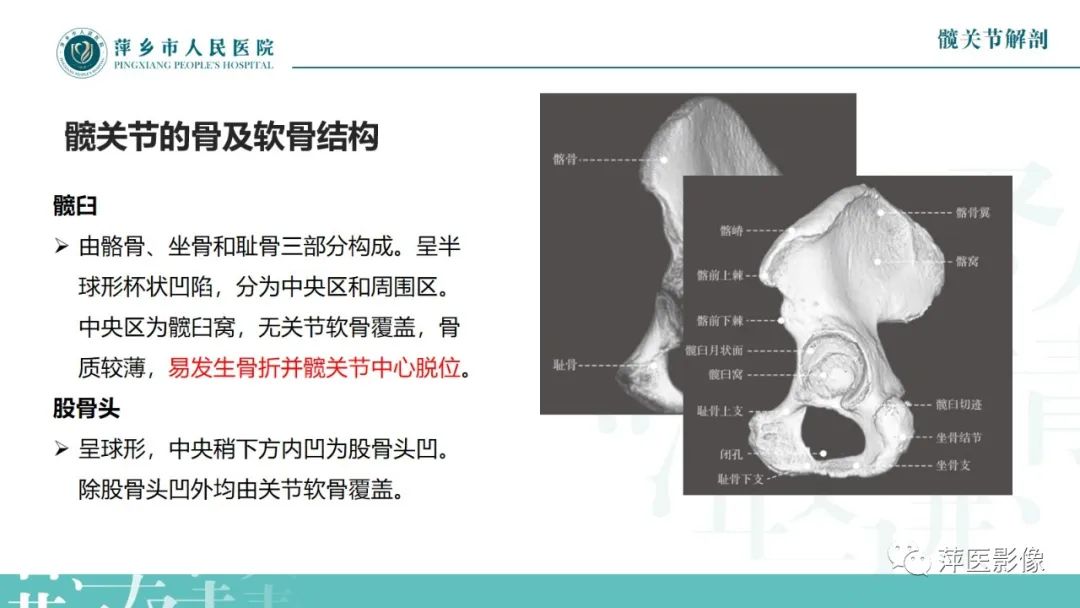 影像PPT - 【PPT】髋关节撞击综合征-5