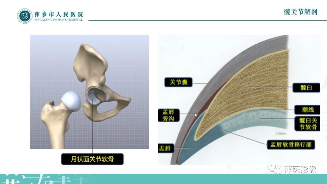 影像PPT - 【PPT】髋关节撞击综合征-7
