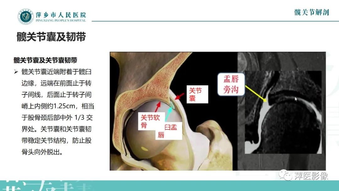 影像PPT - 【PPT】髋关节撞击综合征-8