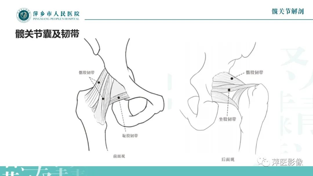 影像PPT - 【PPT】髋关节撞击综合征-10