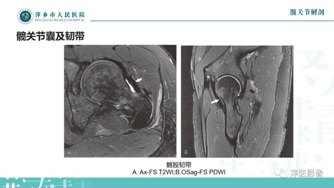 影像PPT - 【PPT】髋关节撞击综合征-11