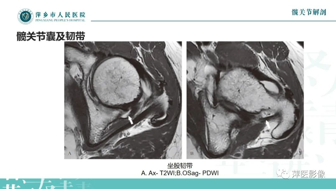 影像PPT - 【PPT】髋关节撞击综合征-13