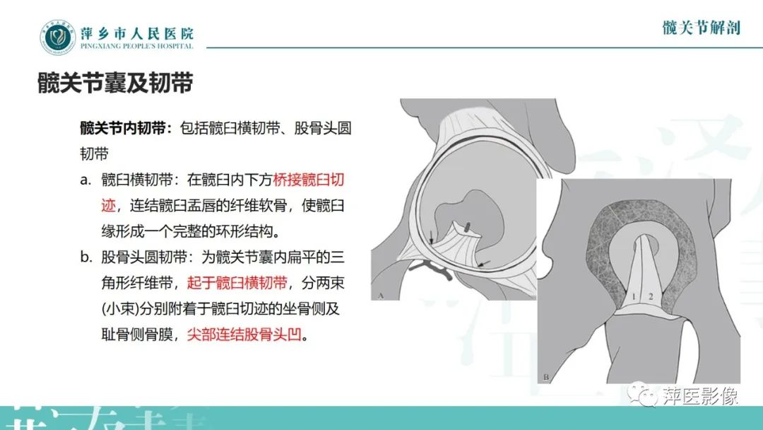 影像PPT - 【PPT】髋关节撞击综合征-14