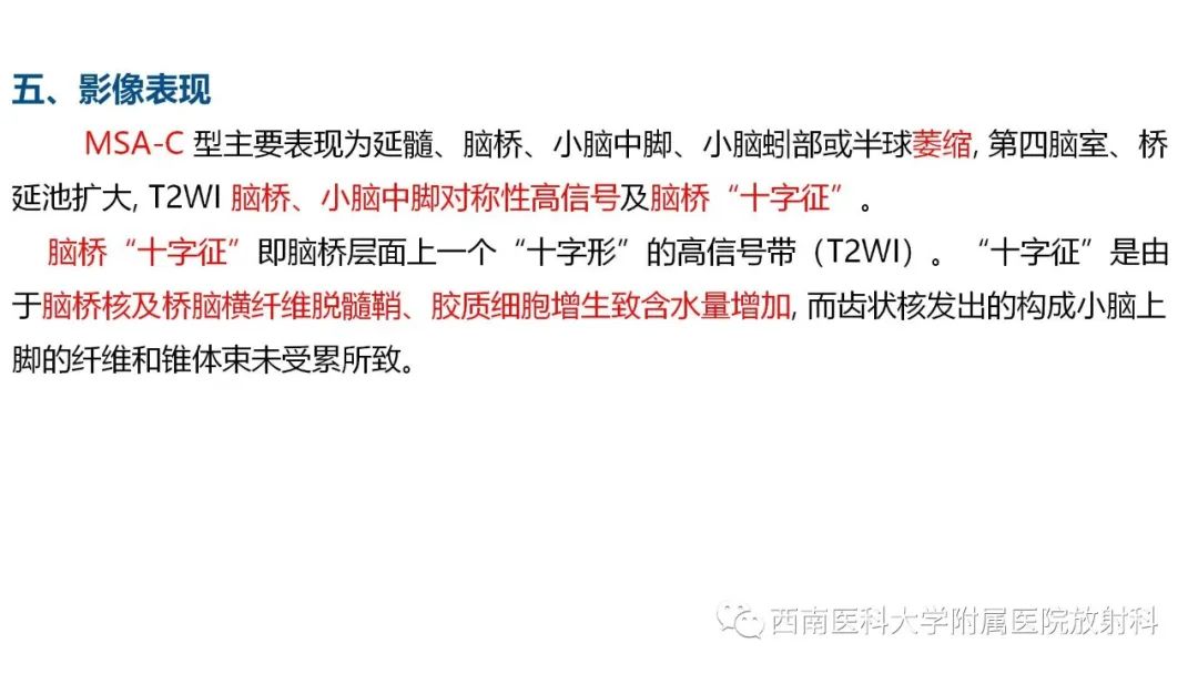 影像PPT - 【PPT】多系统萎缩-7