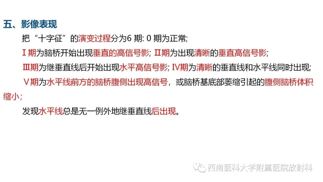 影像PPT - 【PPT】多系统萎缩-8