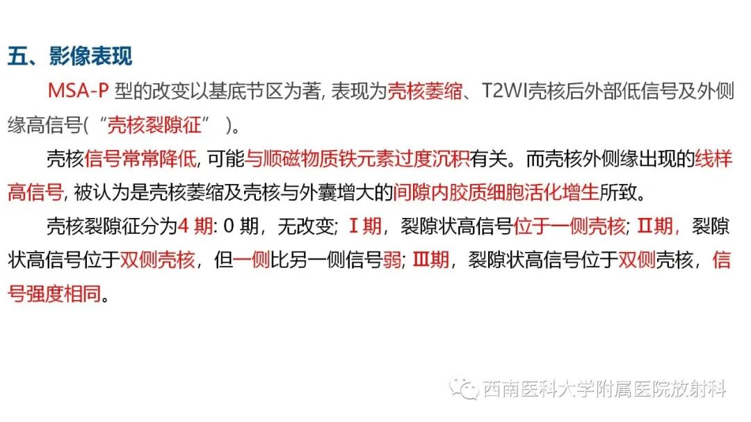 影像PPT - 【PPT】多系统萎缩-9