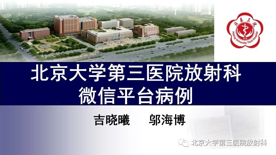 影像PPT - 【PPT】鼻腔鼻窦恶性黑色素瘤-1