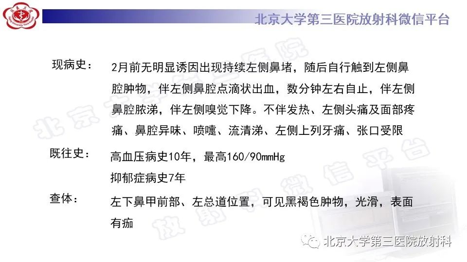影像PPT - 【PPT】鼻腔鼻窦恶性黑色素瘤-2