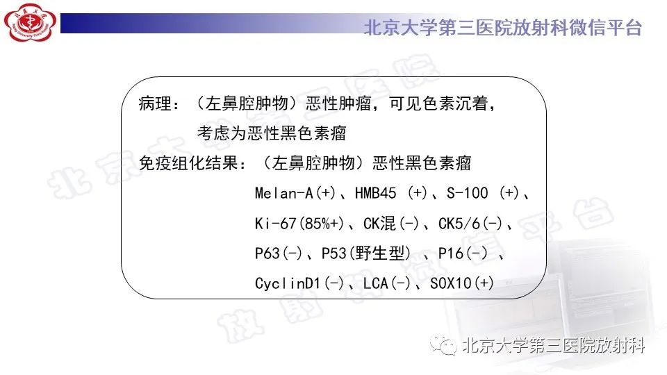 影像PPT - 【PPT】鼻腔鼻窦恶性黑色素瘤-9